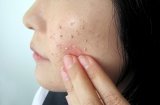 杏のおかげ ぽろぽろゲル 100g