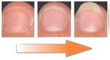 ＜２枚爪・割れ爪・薄く弱った爪＞　～ネイルアミノエッセンス～　スイス生まれの爪用化粧品　アミノ酸を爪に浸透させ健康的な爪へ