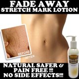 FADE AWAY STRETCH MARK ストレッチマーク治療は妊娠SCARS ＆ケロイドFOR消えていく Sutoretchimāku chiryō wa ninshin SCARS& keroido FOR kieteiku