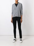 buttoned cardigan