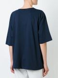 loose top