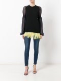 feather trim top