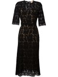 lace midi dress