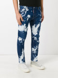 acid wash jeans