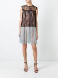 lace detail dress 
