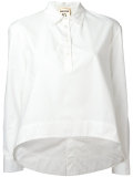 front placket shirt