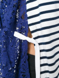 lace back striped top 