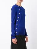 buttons detailing jumper