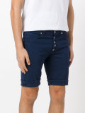 buttoned shorts