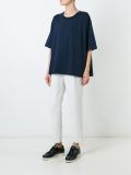 loose top