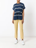 striped drawstring top 