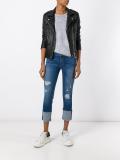 distressed ankle cuff jeans