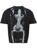 'X-ray'印花T恤