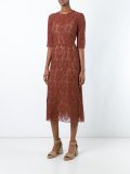 lace midi dress