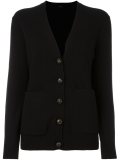 v-neck button down cardigan