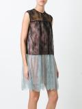 lace detail dress 