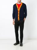 V-neck cardigan