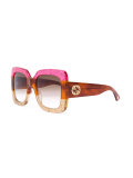 oversized sunglasses