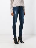 distressed skinny jeans