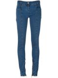skinny zipped cuff jeans