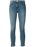skinny cropped jeans