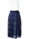 lace trim dress 
