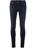 Skinzee jeans