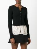 lace detail buttoned cardigan