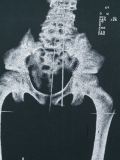 'X-ray'印花T恤