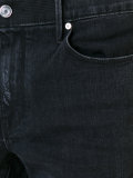 distressed skinny jeans