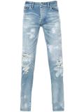 distressed skinny jeans