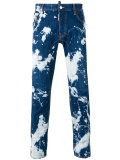 acid wash jeans