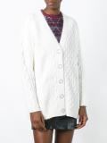 chunky knit cardigan