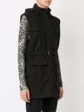 removable hood and sleeves coat