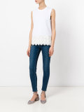 scallop detail tank