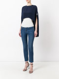 high front top