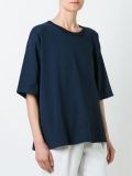 loose top
