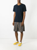 striped bermuda shorts