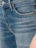 distressed cropped skinny jeans