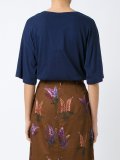 short sleeves body