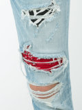 distressed skinny jeans