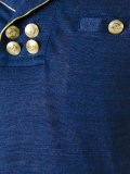 button detail top