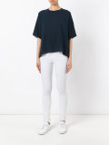 loose fit top