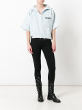 splatter trim skinny jeans  