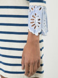 striped dress