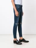 distressed skinny jeans