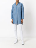 loose-fit shirt