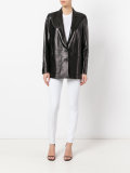 button up jacket 