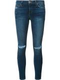 distressed skinny jeans