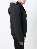removable hood bomber jacket